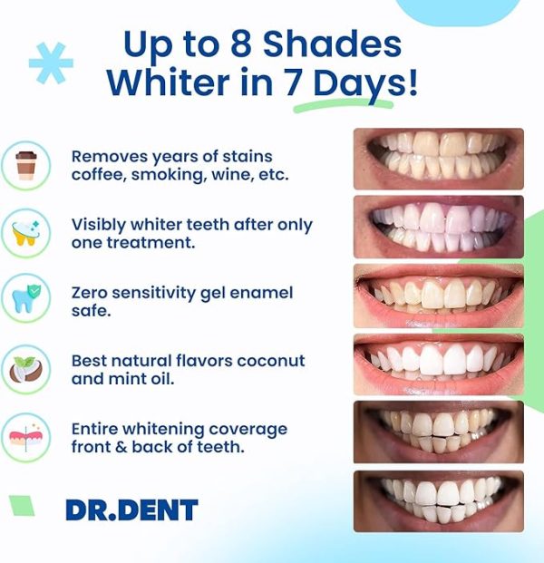 DRDENT Professional Teeth Whitening Strips 7 Treatments - Image 4