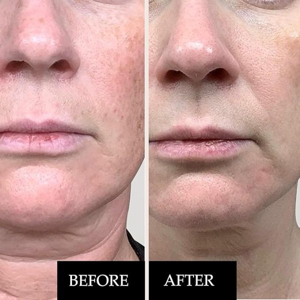 KLEEM ORGANICS Vitamin C Serum for Face 20% - Image 3