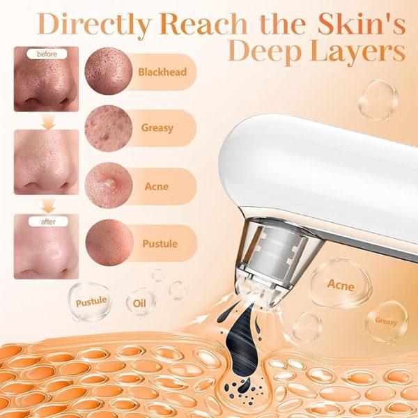 Yccu Blackhead Remover Vacuum - Image 3