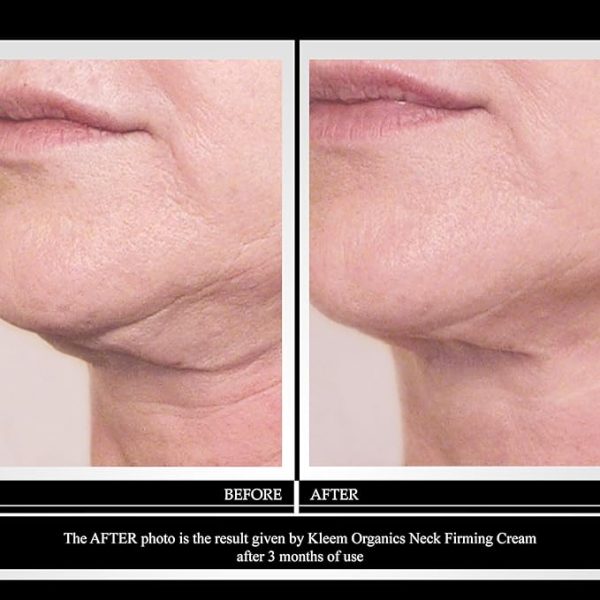 KLEEM ORGANICS Neck Firming Cream with Peptides & Retinol - Image 2